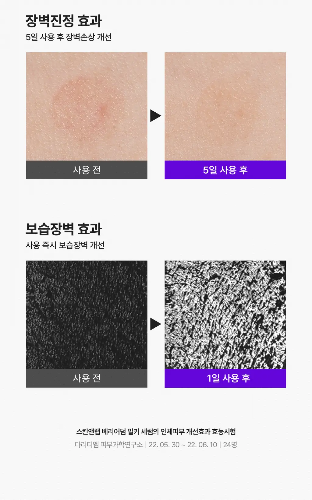 [장벽강화] 스킨앤랩 베리어덤 밀키 세럼 50ml 상세페이지 15
